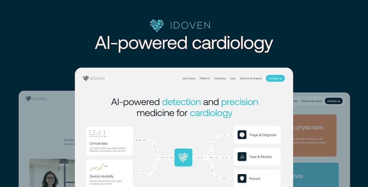 Preview of Idoven